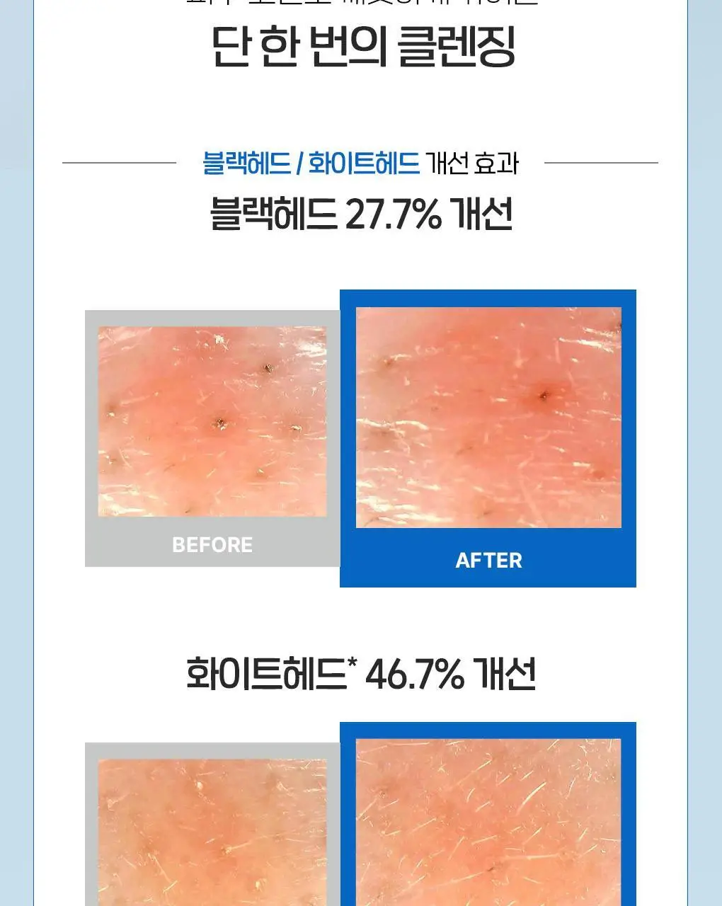 [이나연 PICK] 폰즈 모공 타이트닝 매듭 팩클렌저 150ml 상세페이지 28